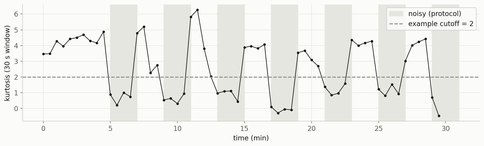 Kurtosis plotted over time, dropping inside each shaded noisy block and rising on clean stretches