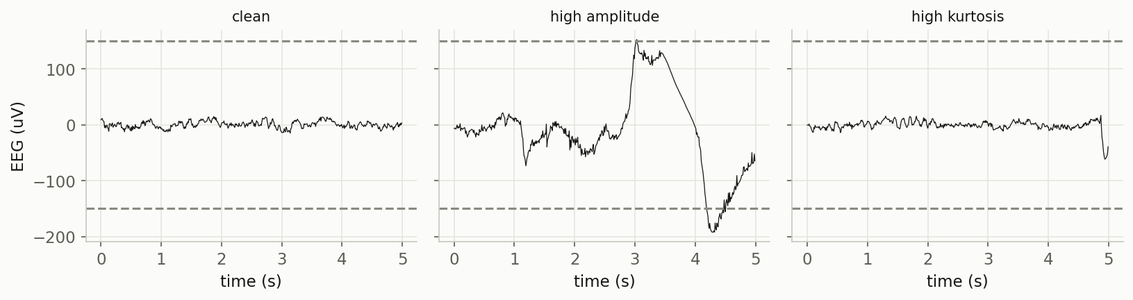 Three EEG segments: a calm clean one, a large slow artifact breaching 150 microvolts, and a small but very spiky one