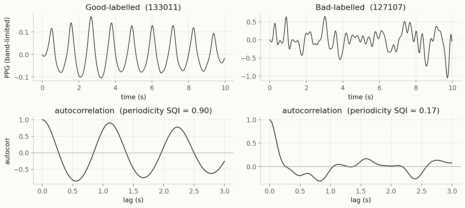 A good PPG recording with regular pulses and a strongly oscillating autocorrelation, next to a noisy recording whose autocorrelation just decays